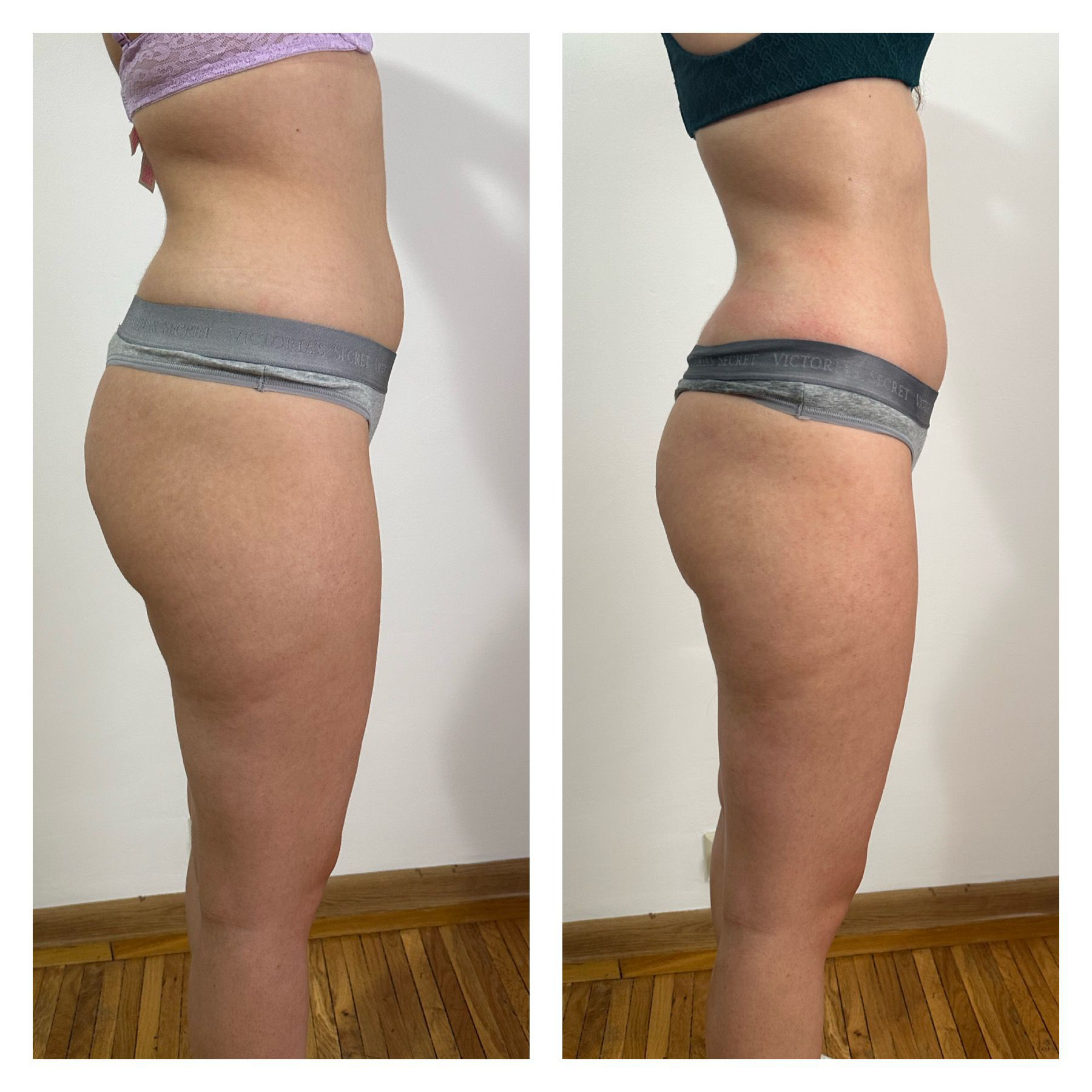 Remodelare corporala - profil